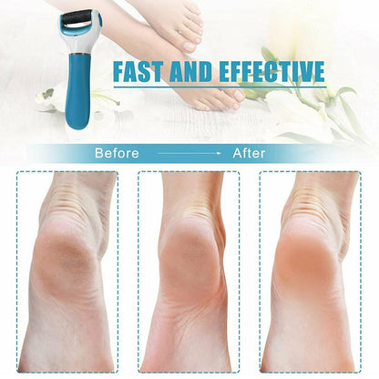 Electronic Dry Foot File, Callous Remover for Feet, Electric Foot with Roller Hard and Dead Skin- Regular Coarse, Baby smooth feet in minutes. For in home padicure foot care, Battery Powered & USB (Battery not included)